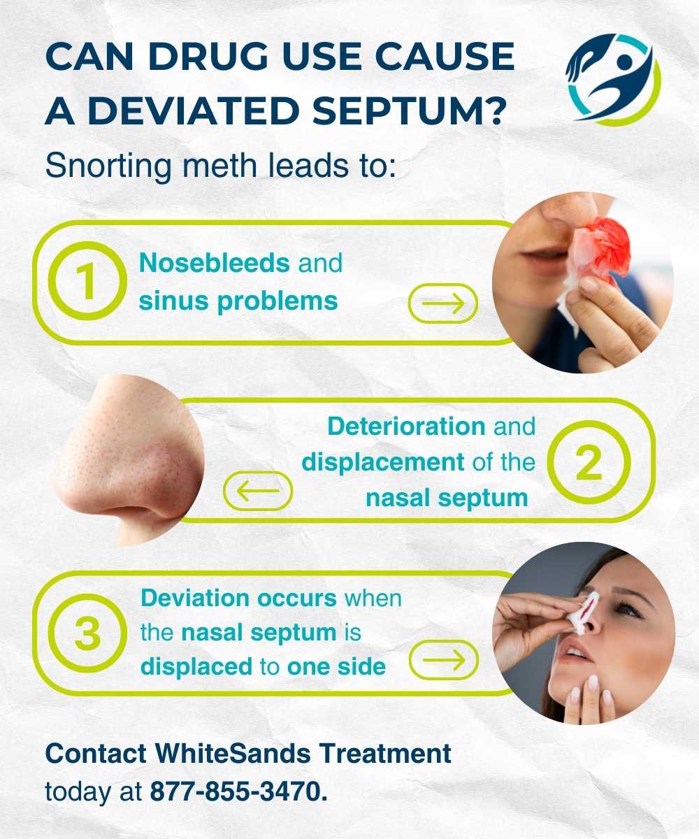 can drug use cause a deviated septum