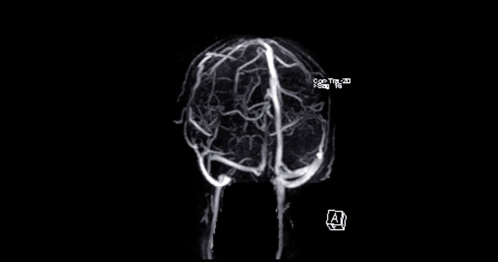 neurobiology of drug and alcohol addiction
