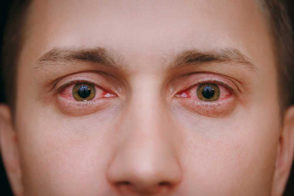 recognizing the signs of cocaine face