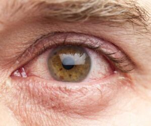 Recognizing Alcohol-Related Eye Changes: What They Mean for Your Health