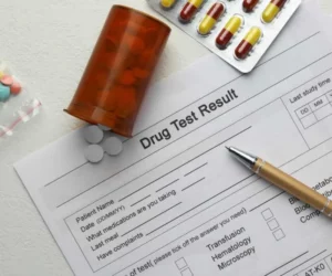 Tramadol and Drug Testing: What You Need to Know