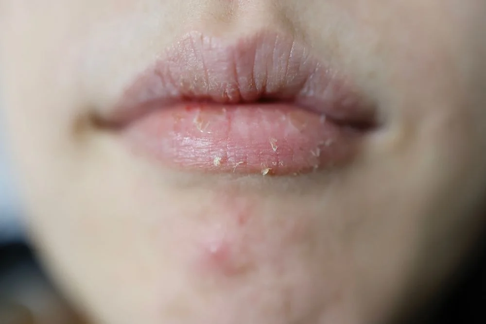 meth mouth risks
